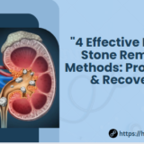 “4 Effective Kidney Stone Removal Methods: Pros, Risks & Recovery”