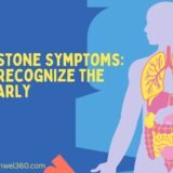 Kidney Stone Symptoms: How to Recognize the Signs Early